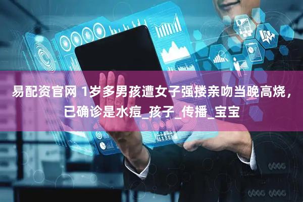 易配资官网 1岁多男孩遭女子强搂亲吻当晚高烧，已确诊是水痘_孩子_传播_宝宝